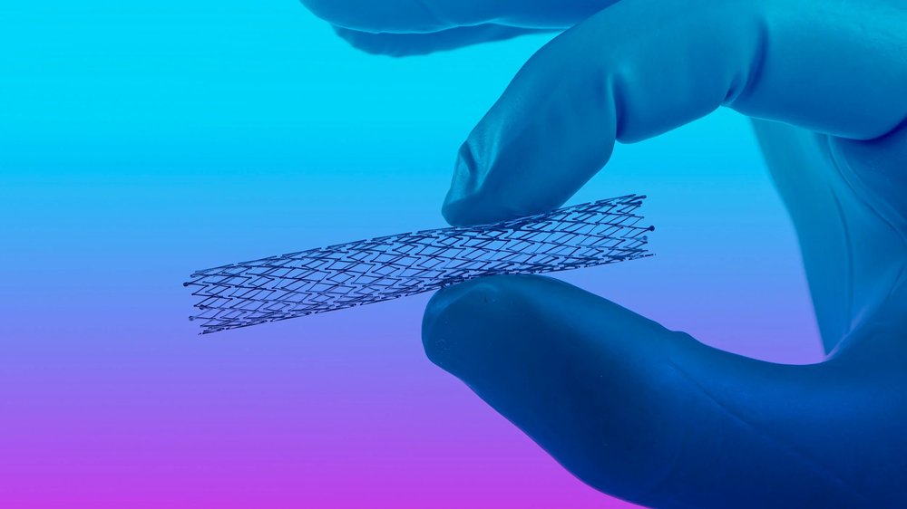Application illustration: Micromachining of stents